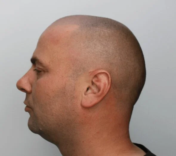 New Contour Haarpigmentatie 4