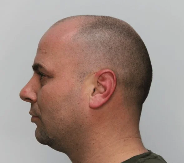 New Contour Haarpigmentatie 3