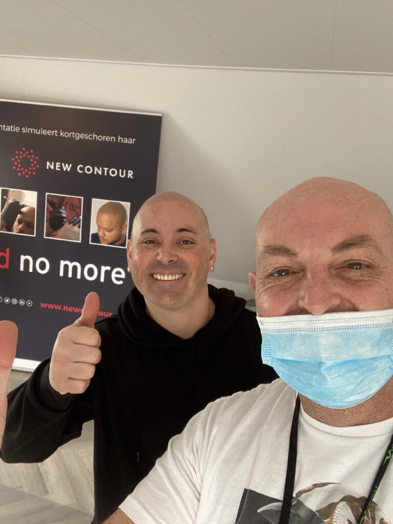 Waar laat je een Micro Haar Pigmentatie behandeling doen