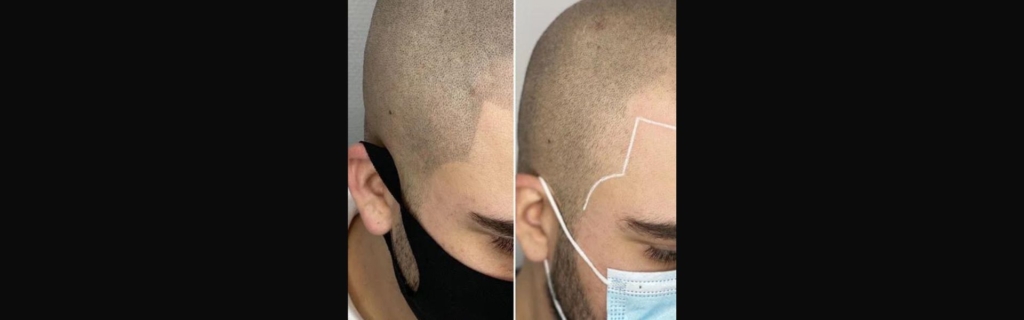 Header Een complete haarlijn en bakkebaard met Micro Shading Een complete haarlijn en bakkebaard met Micro Shading